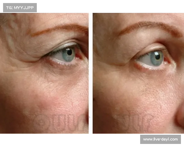 “刘梦阳ONE赛后肩部手术,预计恢复期六个月错失排名战” “刘梦阳ONE赛后肩部手术,预计恢复期六个月错失排名战”